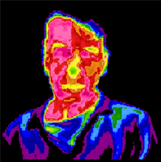 Thermography