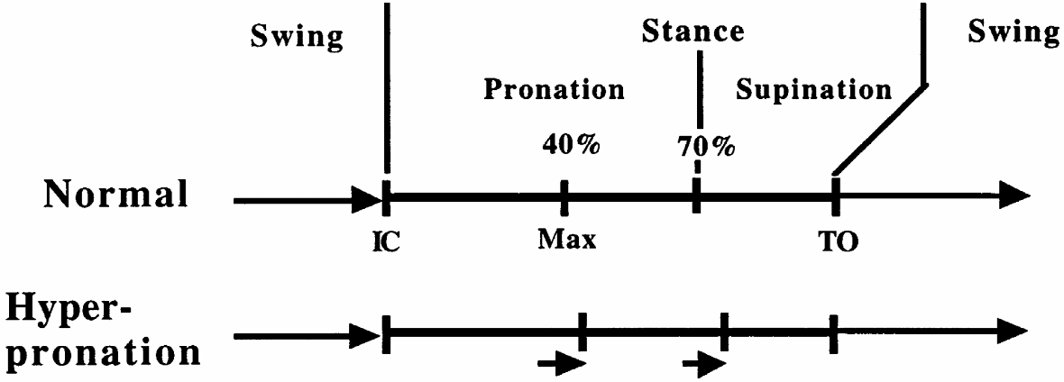 a biomechanic injury as demonstrated